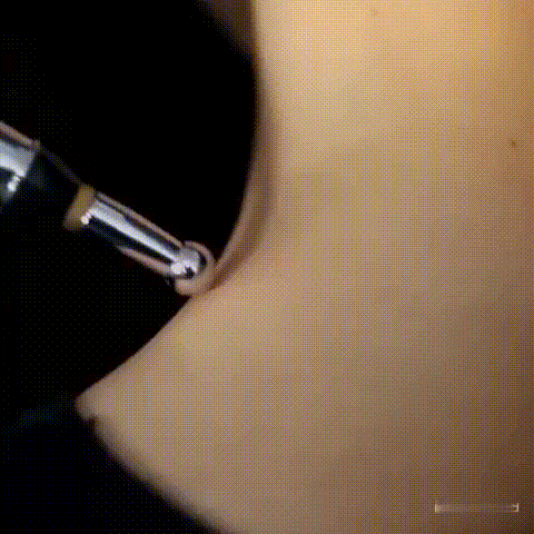 Lápiz Relax Pro  (acupuntura )