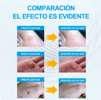 Skin Tag Patches™ Piel libre de verrugas sin dolor